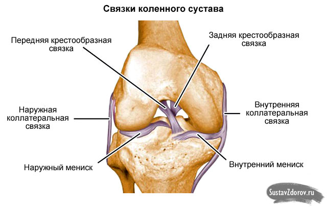 a térd keresztezett ligamentumának részleges károsodása)
