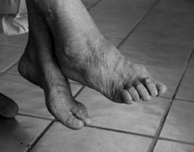 fájdalomcsillapító a bokaízület artrózisában