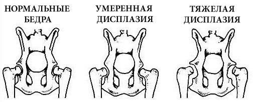 subluxarea adulților a tratamentului articulației șoldului)