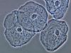 What is squamous epithelium? Squamous cells found