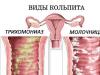 Colpitis (vaginitis): mi ez, okai, tünetei és kezelése