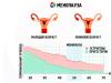 Premenopauza nőknél: a perimenopauza jelei és tünetei, mit kell tenni